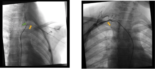 radiografia